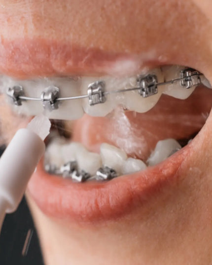 „Smiley Pro Aqua“ belaidis burnos irigatorius, 4 antgaliai ir dovana