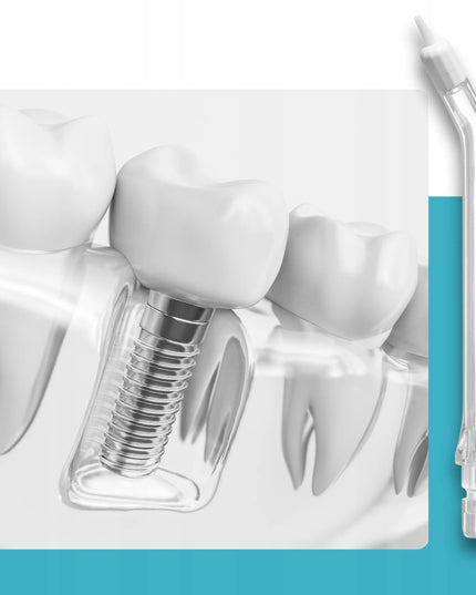 Belaidis burnos irigatorių valymo prietaisas DentalForce, 310 ml