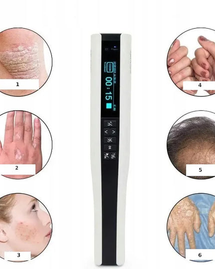 „Kernel“ UVB 311 nm fototerapijos lempa KN-4003BL2 STAND – psoriazei, vitiligui, egzemai ir galvos odai