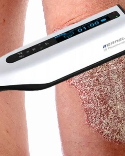 Kernel UVB 311 nm gydomoji lempa KN-4006BL1D nuo psoriazės, vitiligo, egzemos, atopinio dermatito ir židininės alopecijos