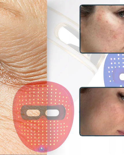 Fit4Med LED veido kaukė fototerapijai – 4 režimai, valdymo pultelis ir dovanų maišelis