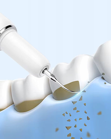 ULTRAGARSINIS DANTŲ SKALERIS - 5 REŽIMAI DANTŲ AKMENIMS PAŠALINTI