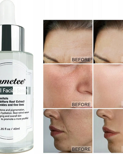 Immetee Retinol serum veidui – regeneracija, kova su aknės randais ir raukšlėmis