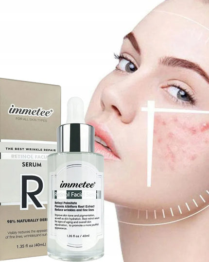 Immetee Retinol serum veidui – regeneracija, kova su aknės randais ir raukšlėmis