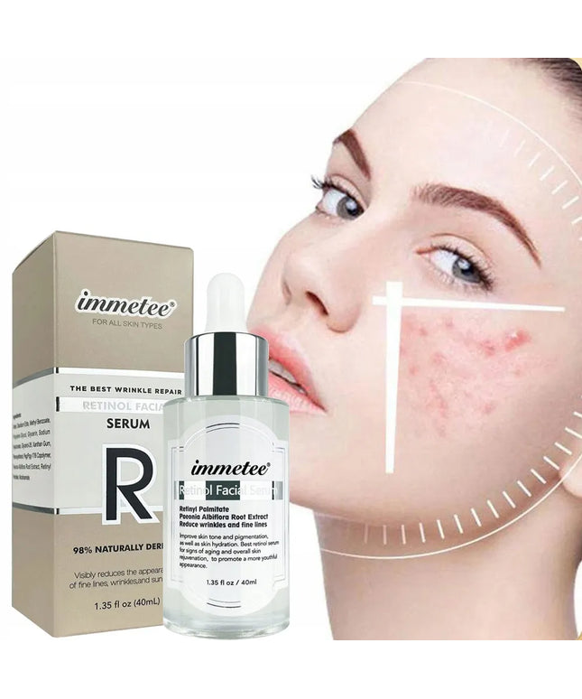 Immetee Retinol serum veidui – regeneracija, kova su aknės randais ir raukšlėmis