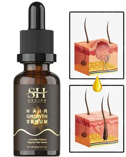 Sevich imbiero serum, mažinantis plaukų slinkimą ir skatinantis augimą