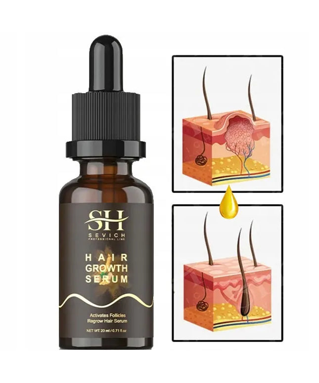 Sevich imbiero serum, mažinantis plaukų slinkimą ir skatinantis augimą