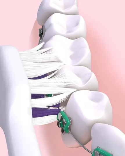 GUM Sonic Ortho White garsinis dantų šepetėlis