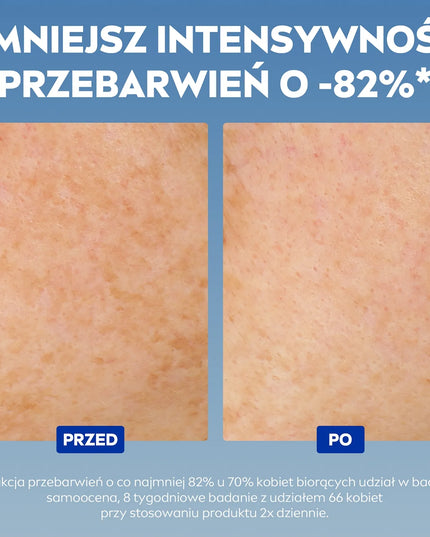 NIVEA Cellular Luminous630 intensyvus serumas nuo pigmentinių dėmių, 30 ml